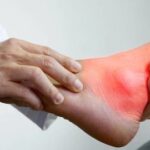 Ilustrasi makanan penyebab asam urat tinggi purin