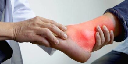 Ilustrasi makanan penyebab asam urat tinggi purin